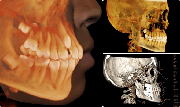 Radiología Tridimensional 3D