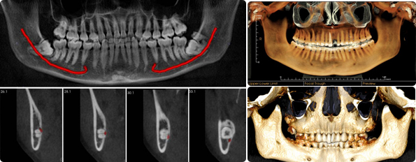 Radiología Tridimensional 3D